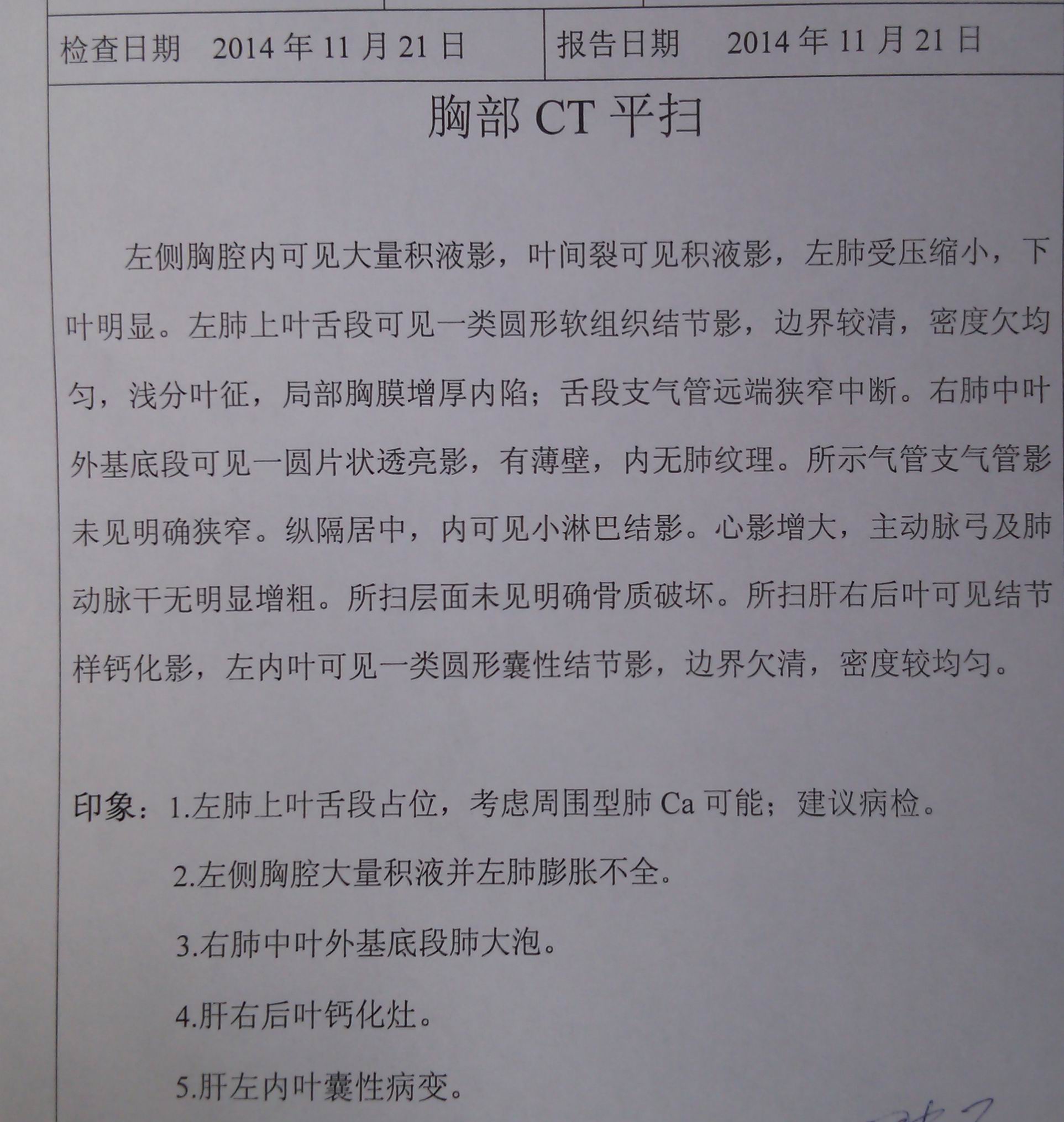 CT结果