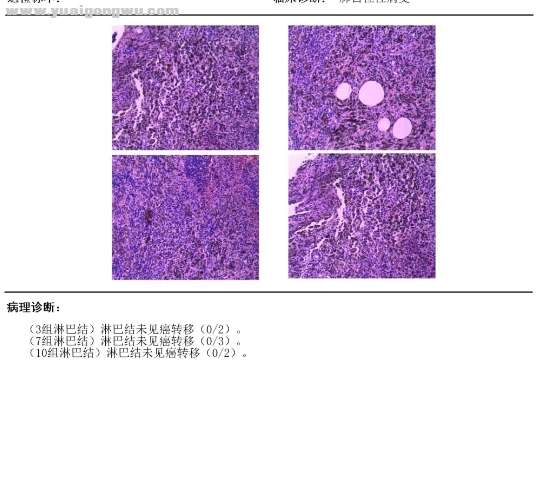 病理报告02